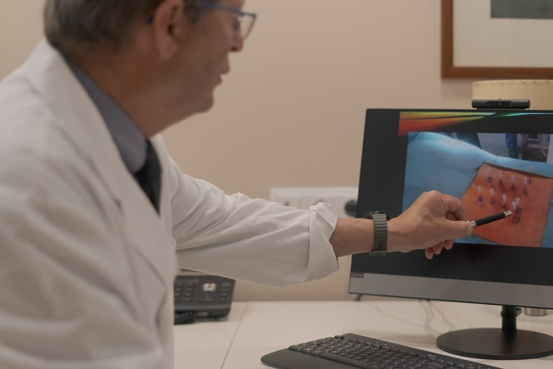 Acupuntura médica para la artrosis: cómo funciona, qué dice la ciencia y cuándo es la mejor opción