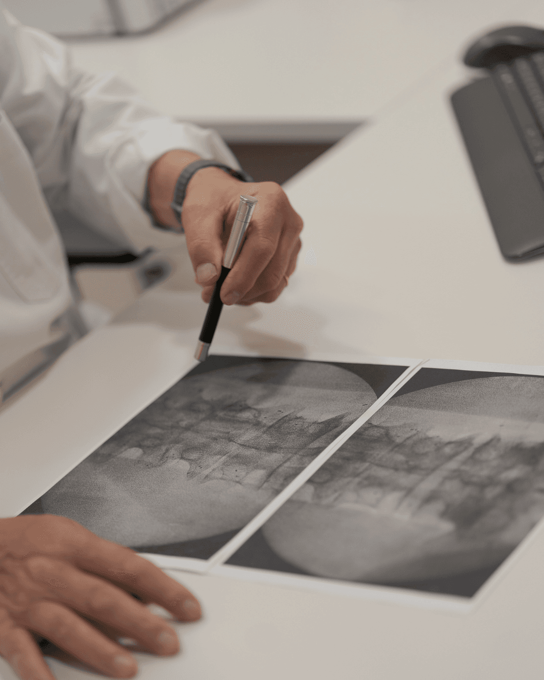 Médico señala con un bolígrafo una radiografía de la columna vertebral sobre un escritorio.